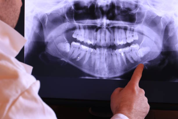 Best Broken or Chipped Tooth Repair in Harrison, TN